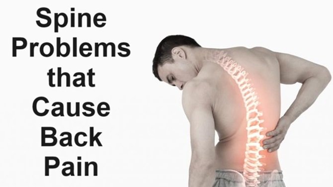 Spine Problems that Cause Back Pain